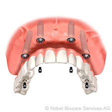 Clinică de top – printre primele în domeniul implanturilor dentare în Europa leading-clinic-among-the-first-in-dental-implants-in-europe-small