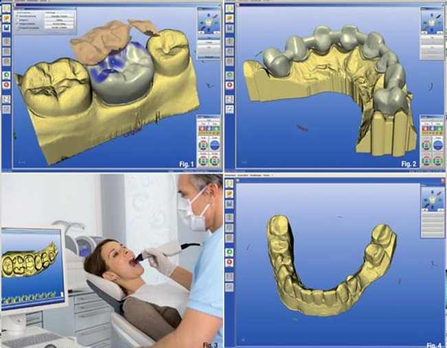 CEREC-3-rendszer-kep-2